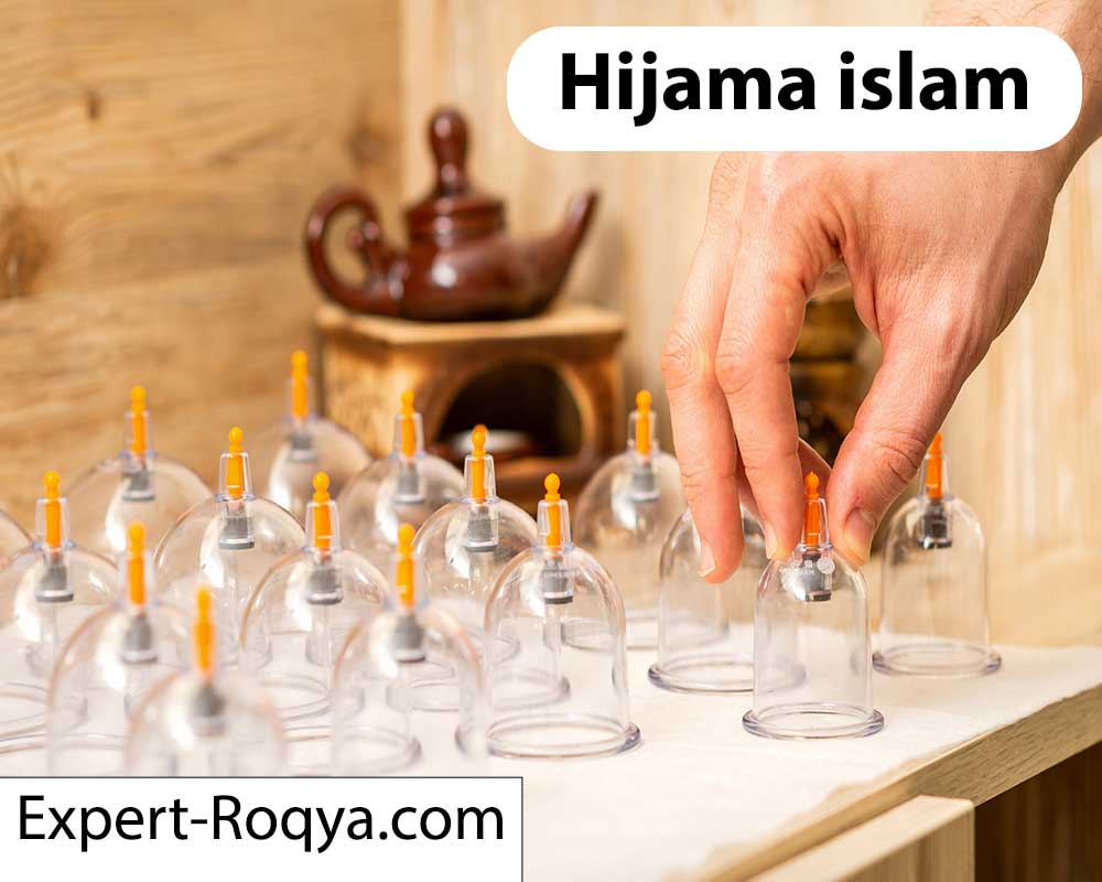 hijama